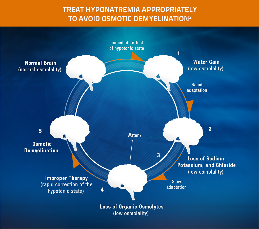 Hyponatremia Osmotic Demyelination Syndrome