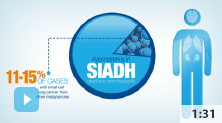 Hyponatremia in SIADH in Oncology